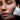 5-Minute Facial-Lift®