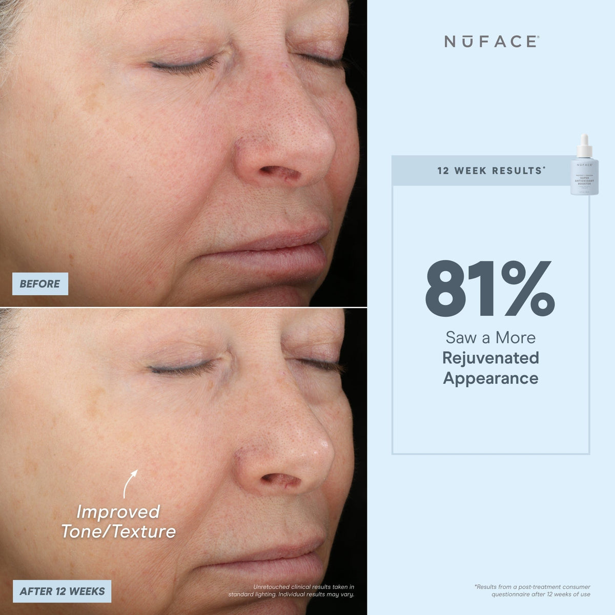 before and after infographic of nuface super booster