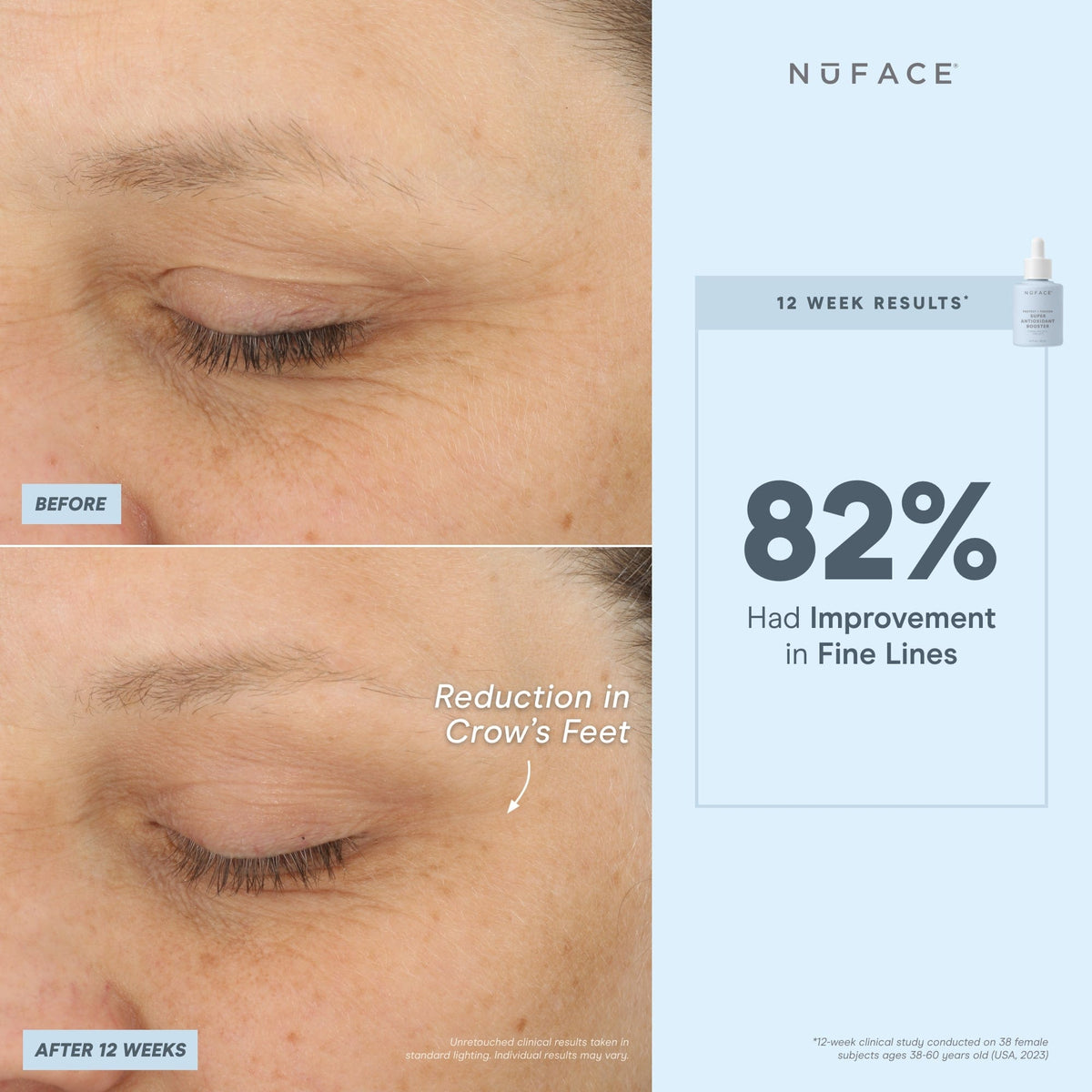 before and after infographic of nuface super booster