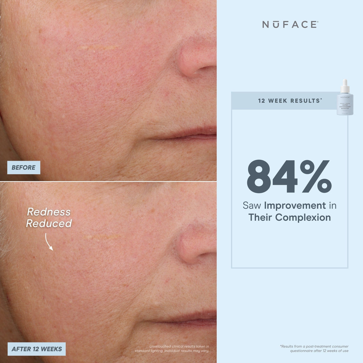before and after infographic of nuface super booster