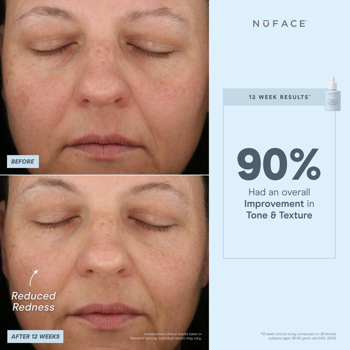 before and after infographic of nuface super booster
