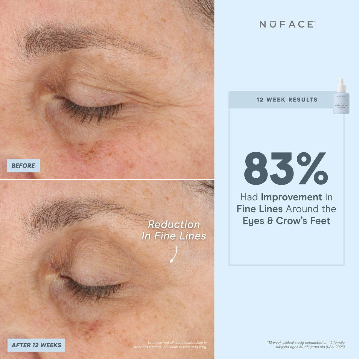 before and after infographic of nuface super booster