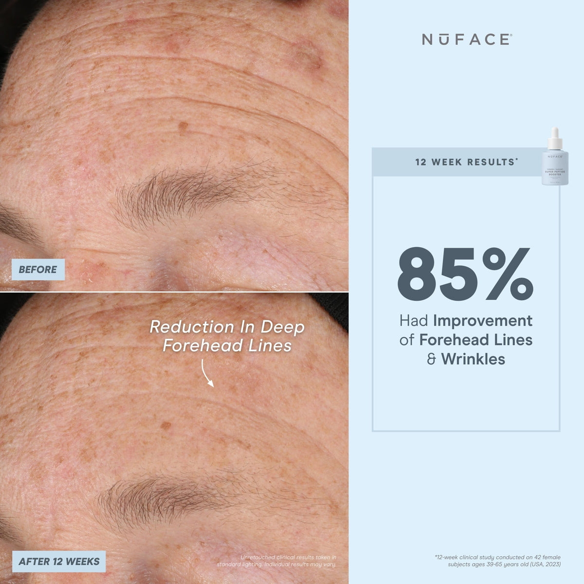 before and after infographic of nuface super booster
