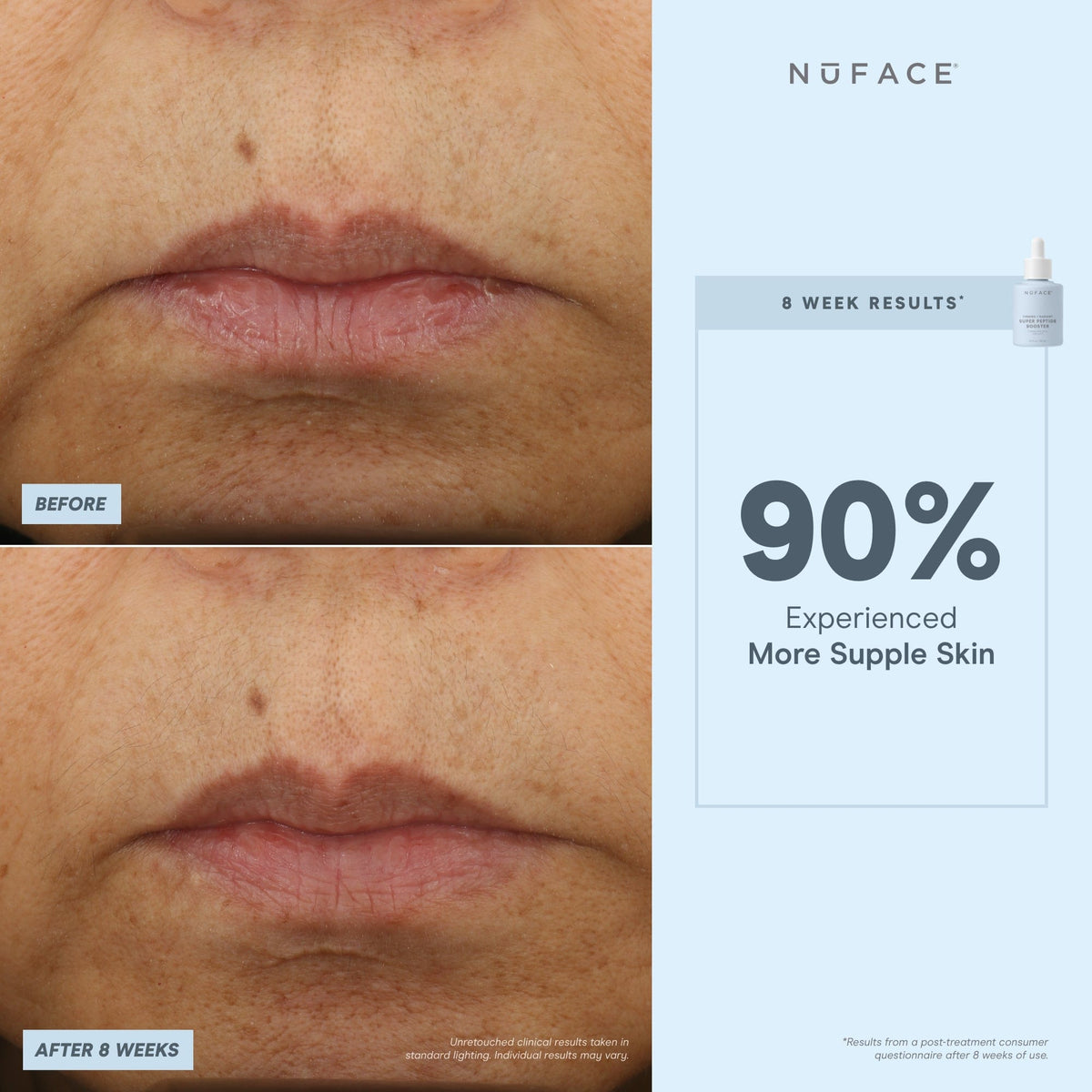 before and after infographic of nuface super booster