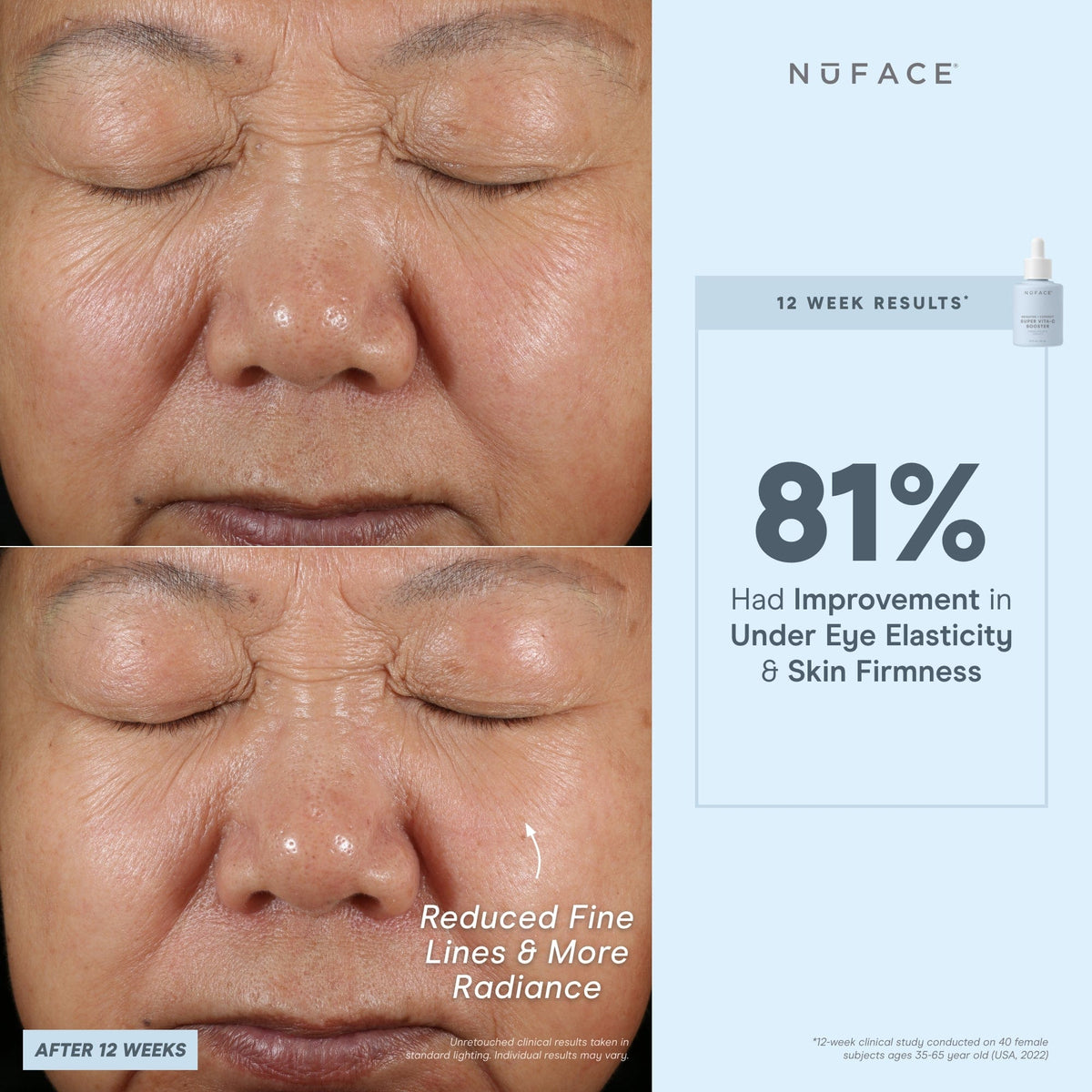 before and after infographic of nuface super booster