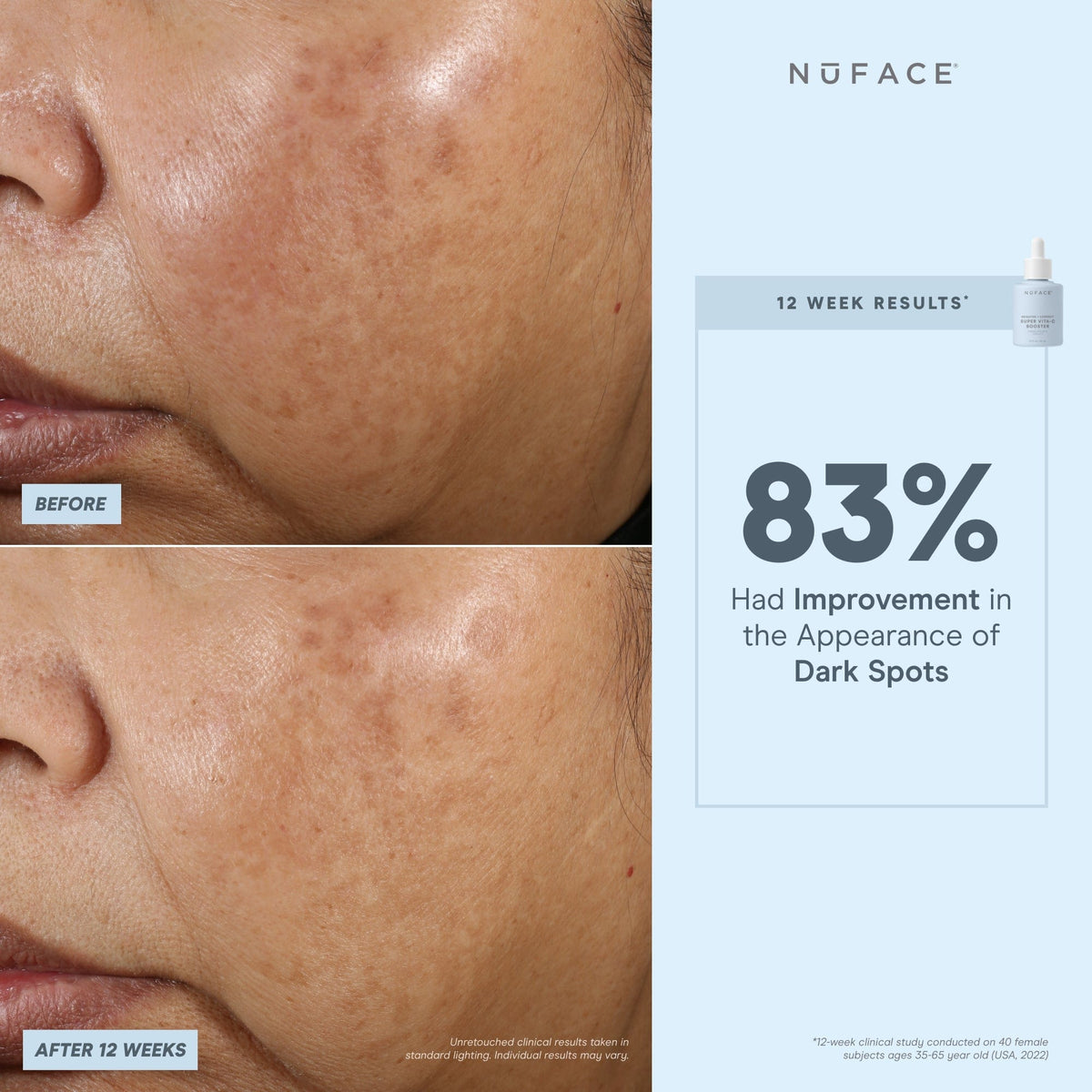 before and after infographic of nuface super booster