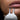 Lip and eye treatment