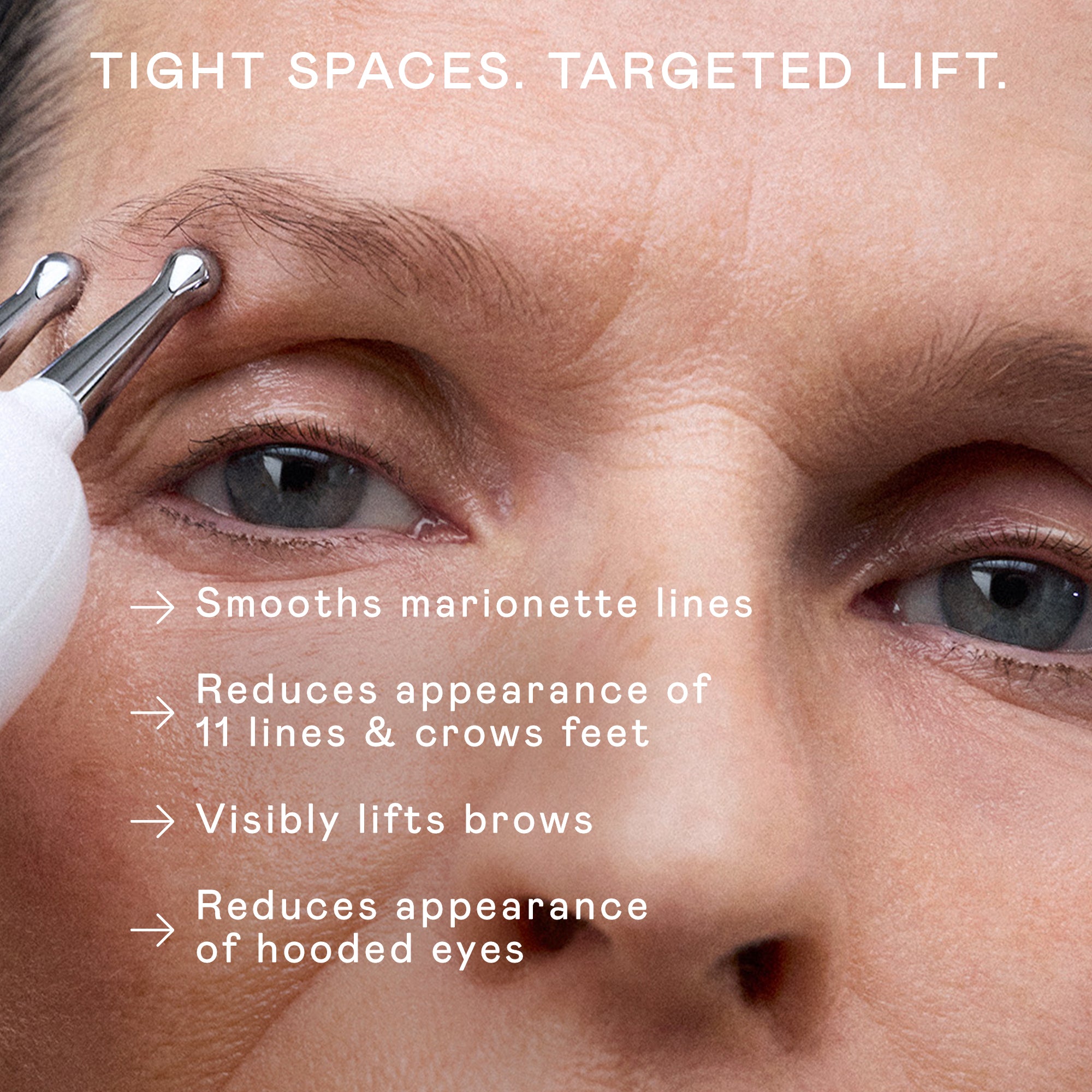 NUFACE Trinity Classic ELE Attachment for Smile Lines & Eye Wrinkles