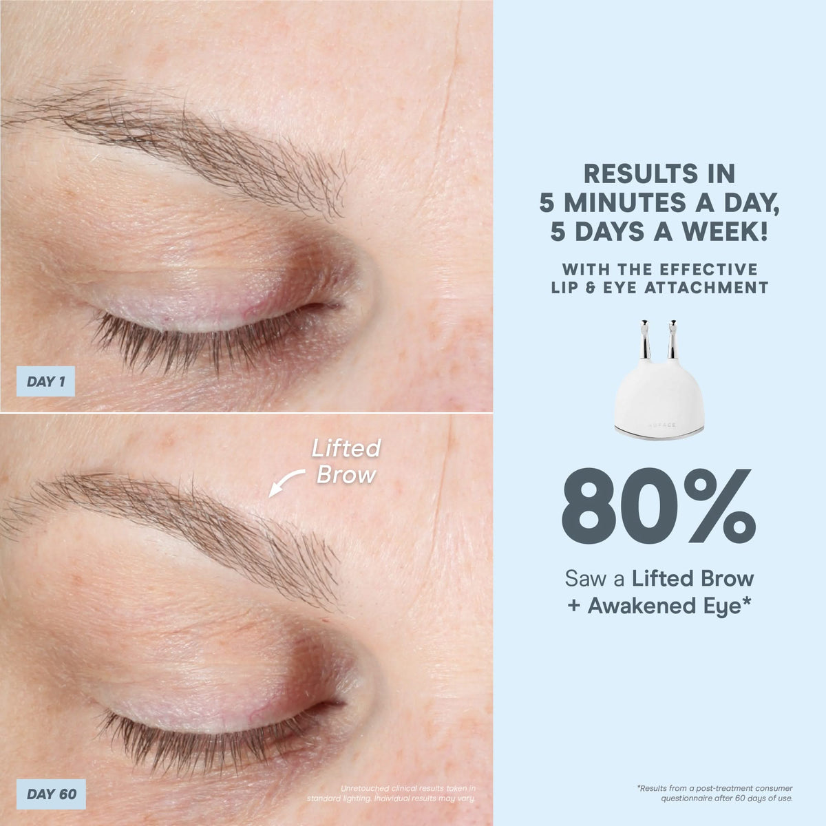 TRINITY+ Effective Lip & Eye Attachment - Targeted Attachment for TRINITY+