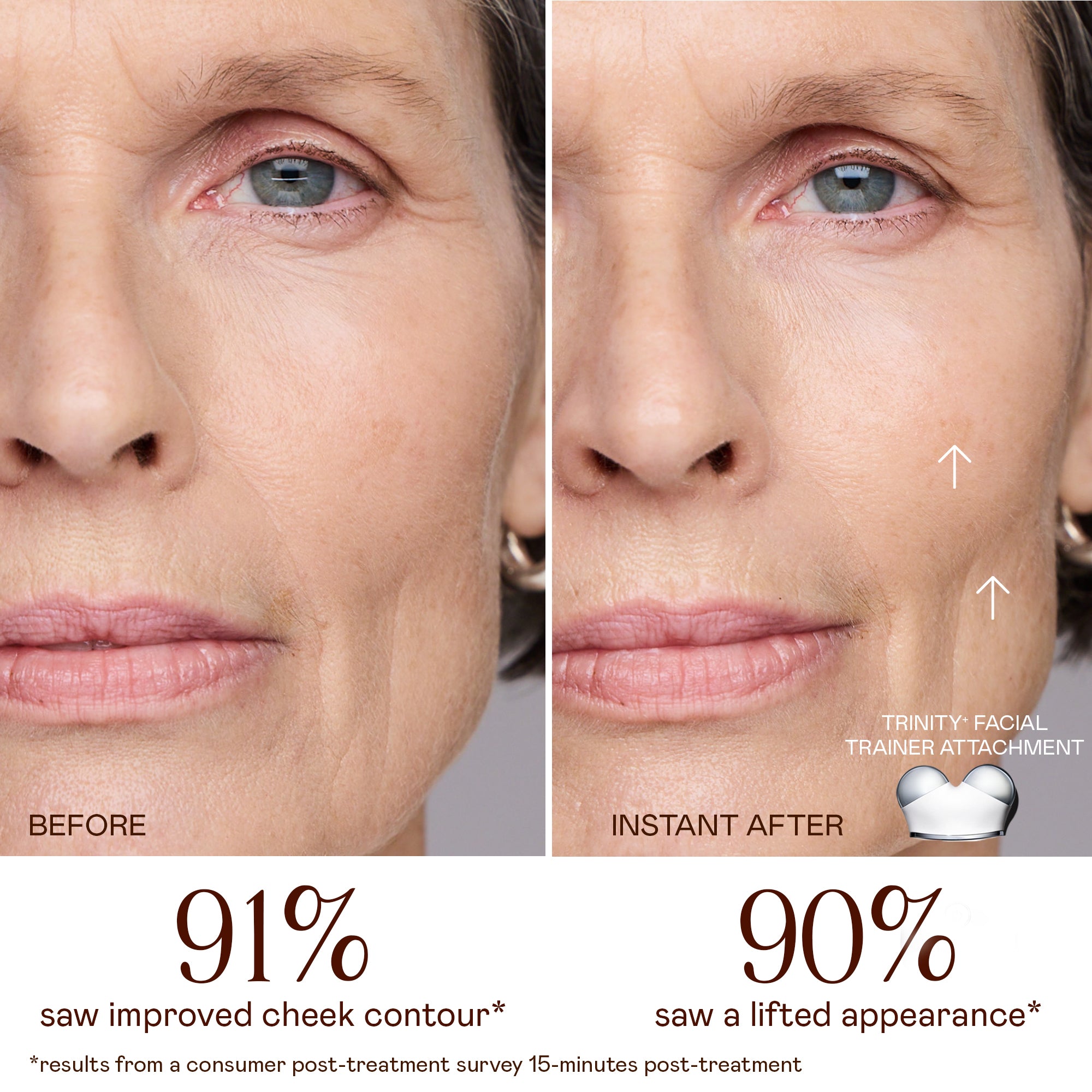 Replacement Facial Trainer Attachment for TRINITY+ Microcurrent