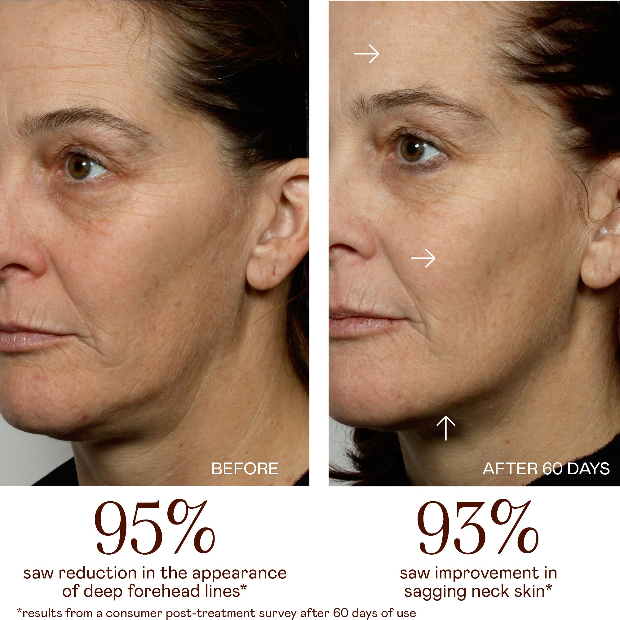 MINI+ Portable Microcurrent Facial Toning Kit | NUFACE – NuFACE