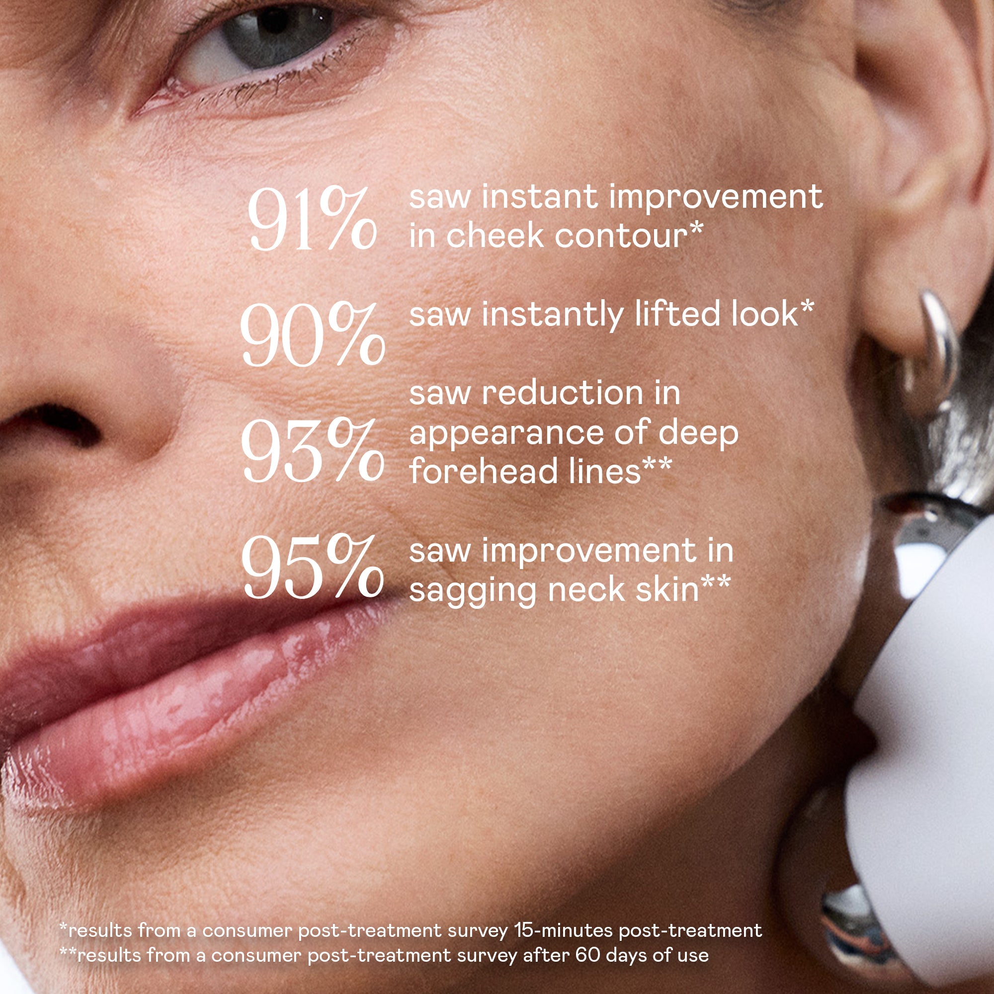 Replacement NuFACE Trinity Classic Facial Trainer Attachment – NUFACE