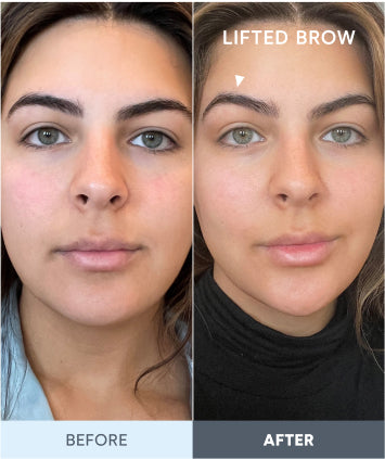 90 percent Saw a Lifted Appearance