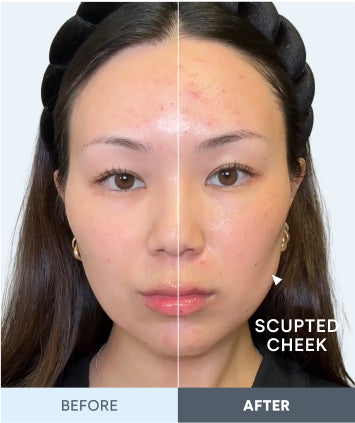 91 percent Saw Improved Cheek Contour