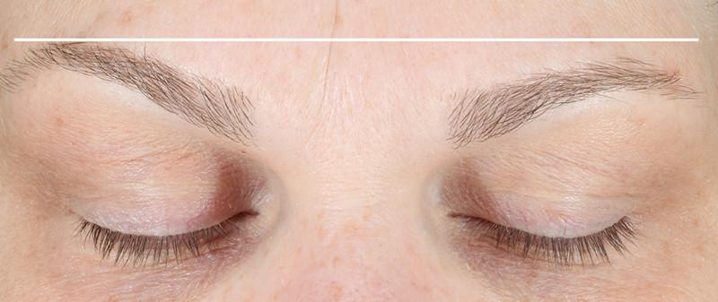 Close shot of eyebrows after using NuFace Trinity. They are raised.
