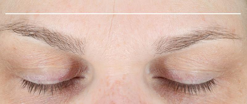 Close shot of eyebrows before using NuFace Trinity