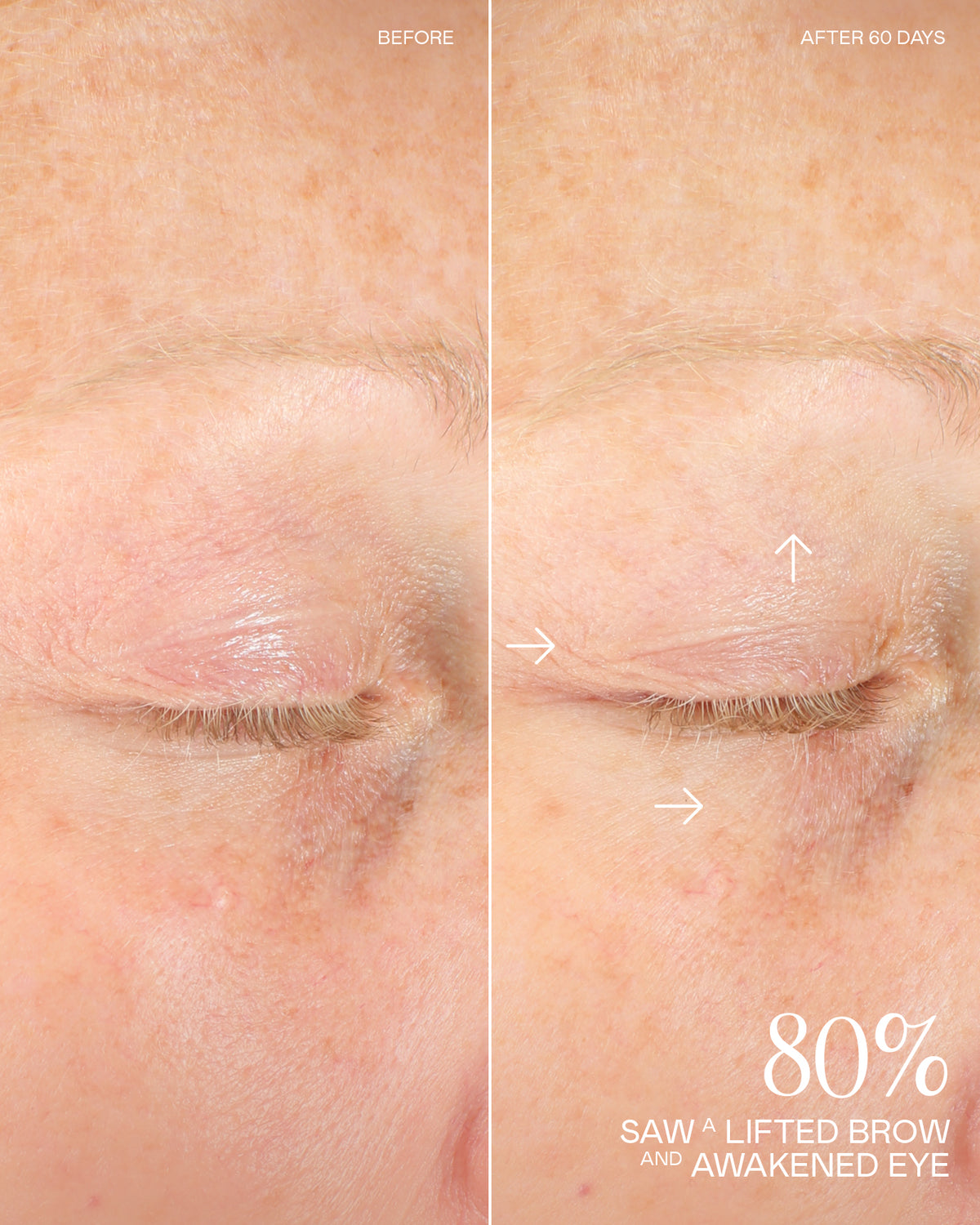 Before and After Results