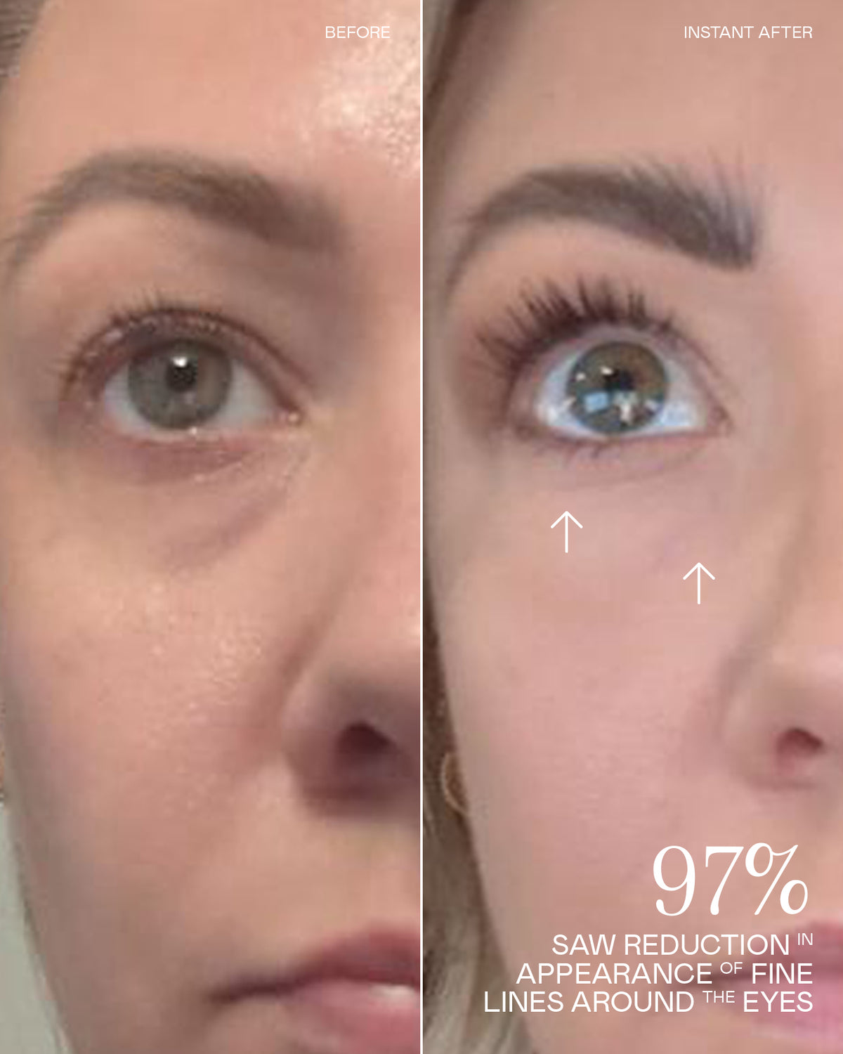 Before and After Results
