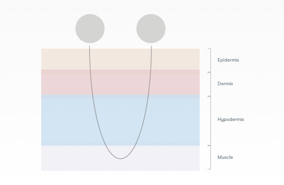 Microcurrent Therapy, Microcurrent Facials & More | NuFACE