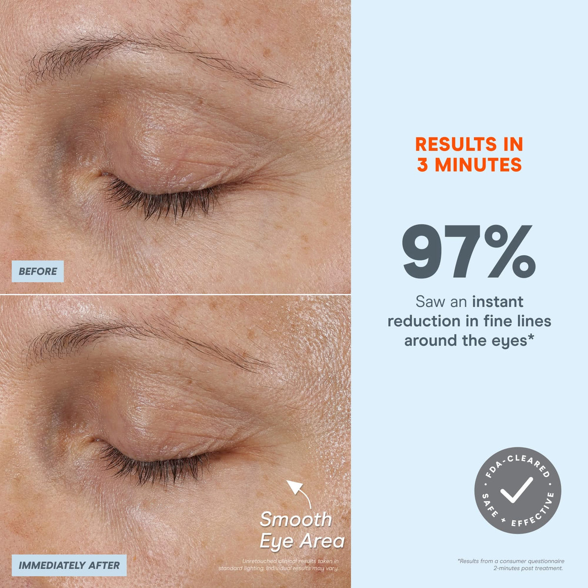 FIX MicroWand - Eyes, Lips & Lines Microcurrent Device