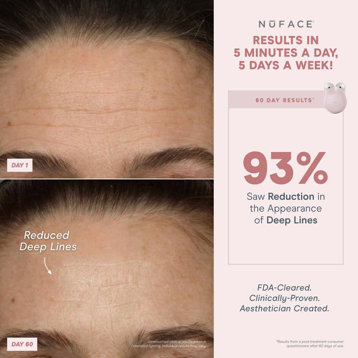 Color::Sandy Rose,Color::Violet Dusk,Color::Midnight Black,Color::Brilliant White,Color::Sunset Blush,Color::NuBlue