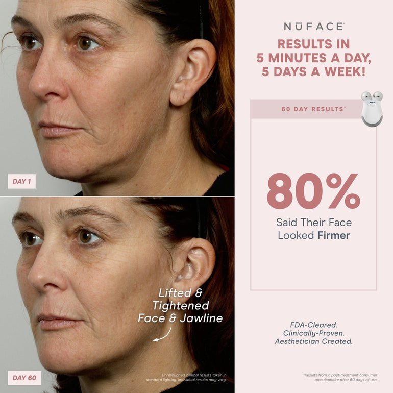 Mini Facial Toning Devices And Sets – NuFACE