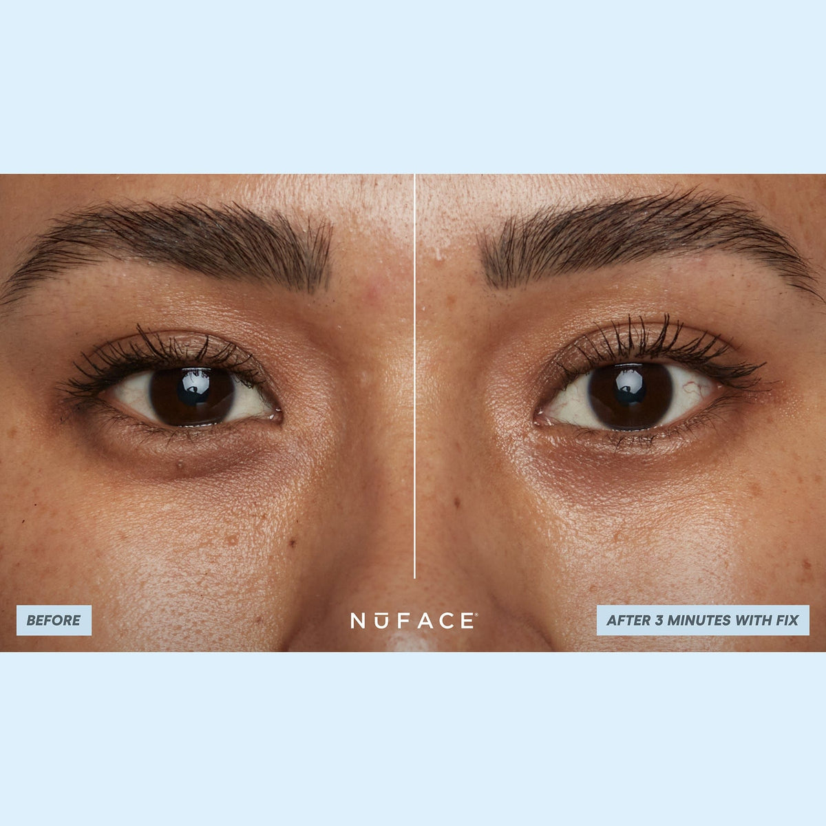 IonPlex® Hydra-Gel Power Patches - Brightening and Tightening Under Eye Masks