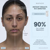 TRINITY+ Complete Set - Smart Advanced Facial Toning Kit