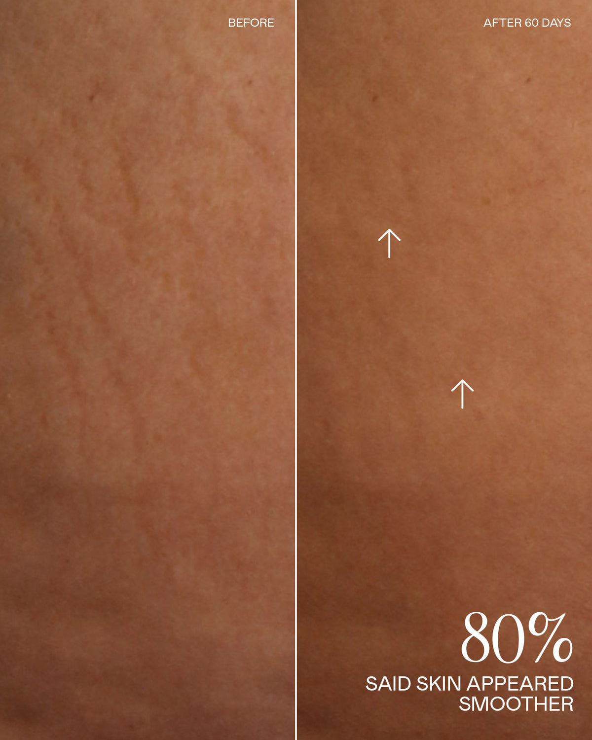 Before and After Results