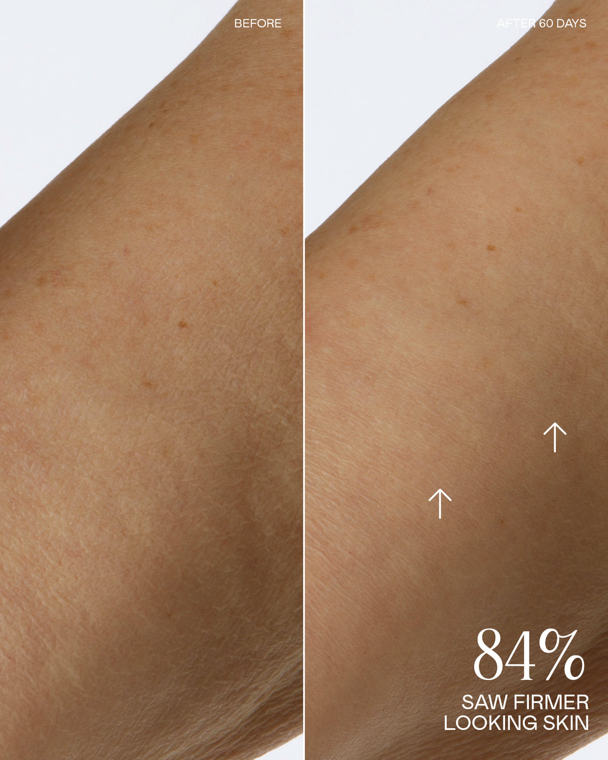 Before and After Results