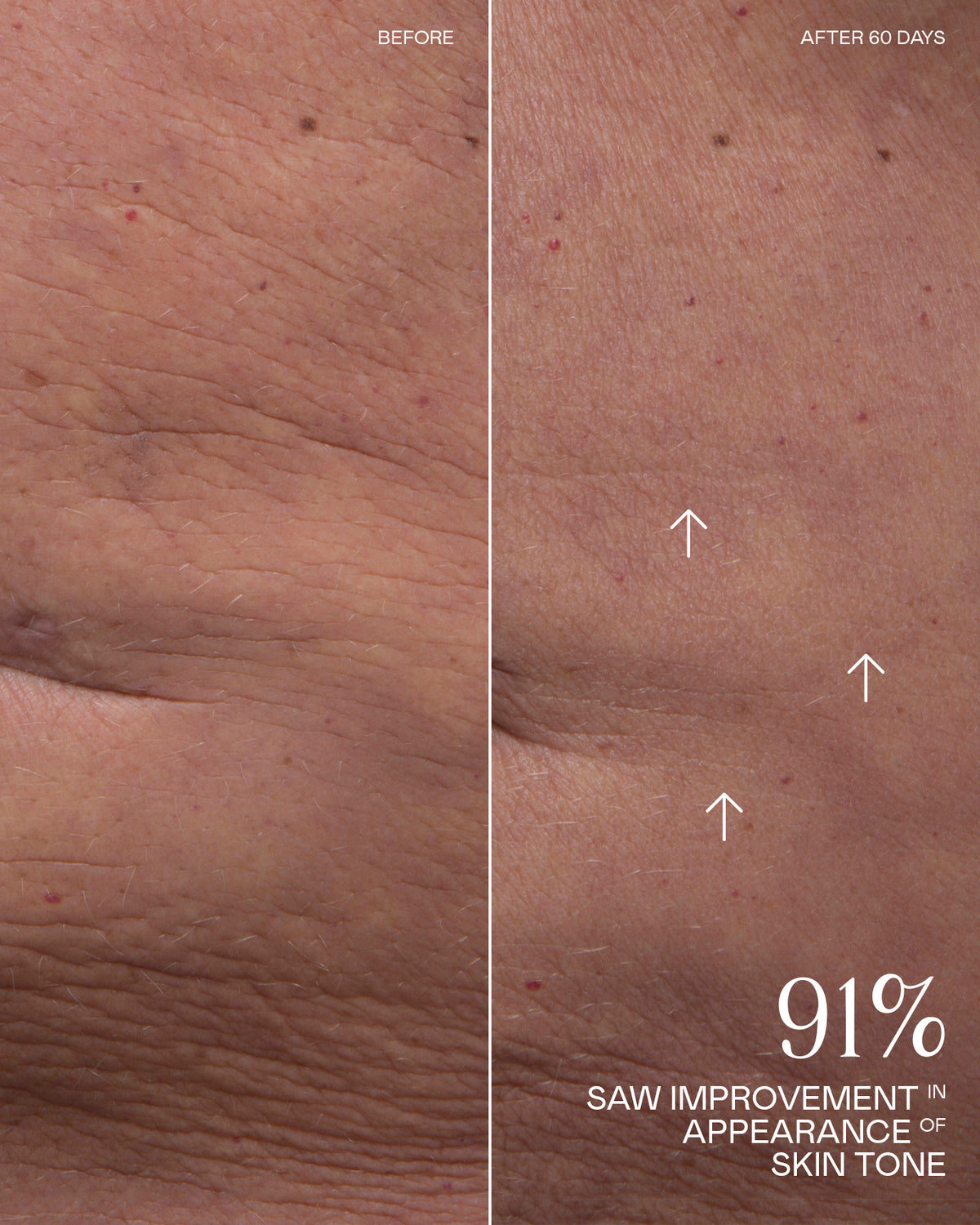 Before and After Results