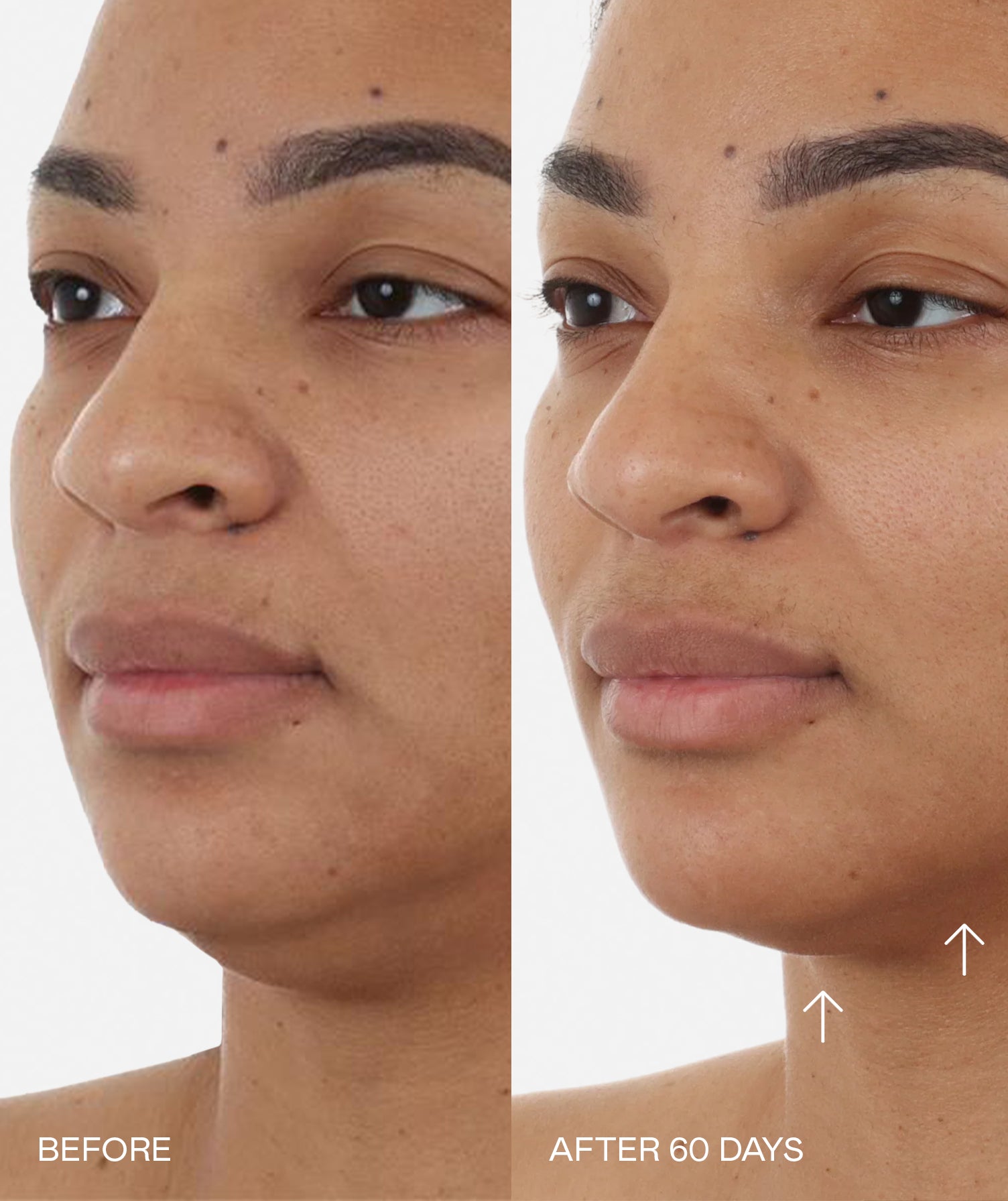 NUFACE Microcurrent Facial Toning Devices & Skincare NUFACE Microcurrent Facial Toning Devices & Skincare
