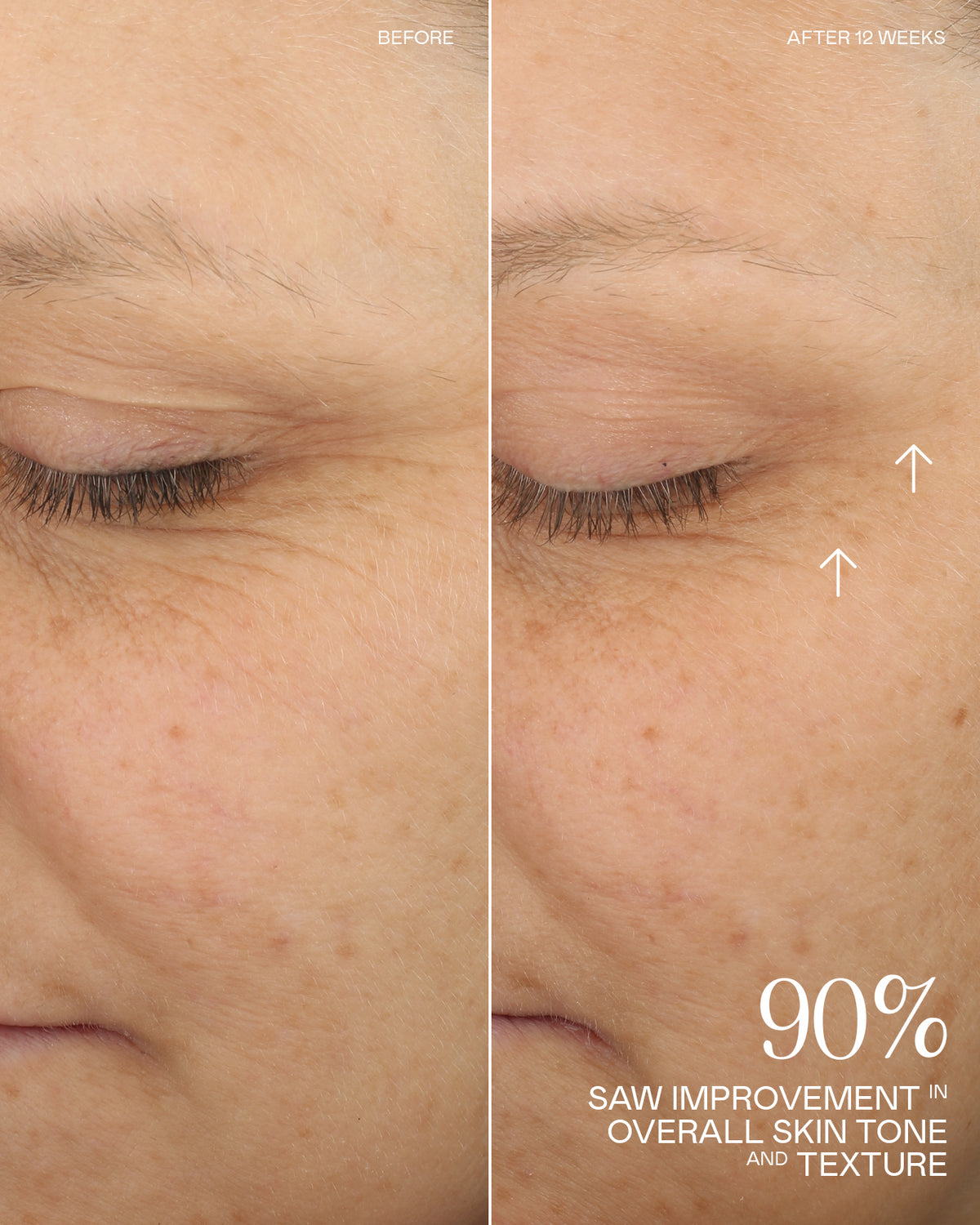 Before and After Results
