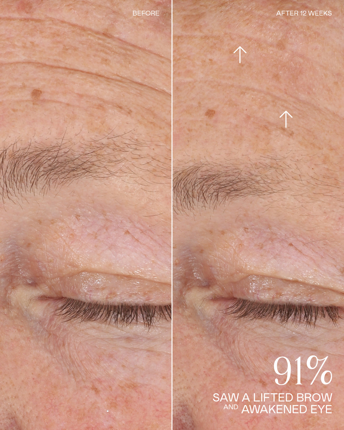 Before and After Results