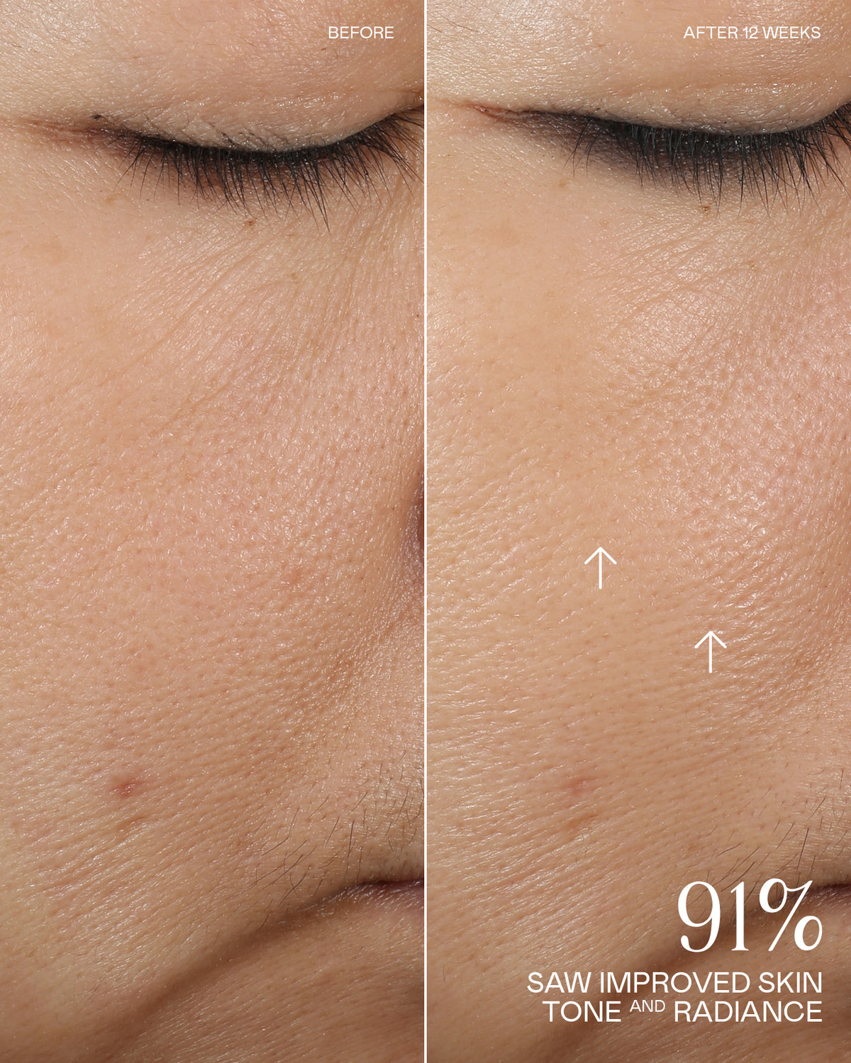 Before and After Results