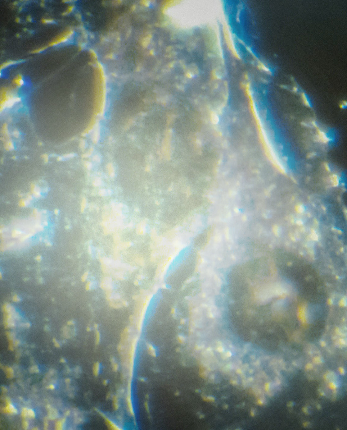 Ceramides