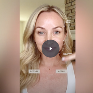 a video thumbnail of a happy NuFACE woman showing photos before and after NuFACE treatment