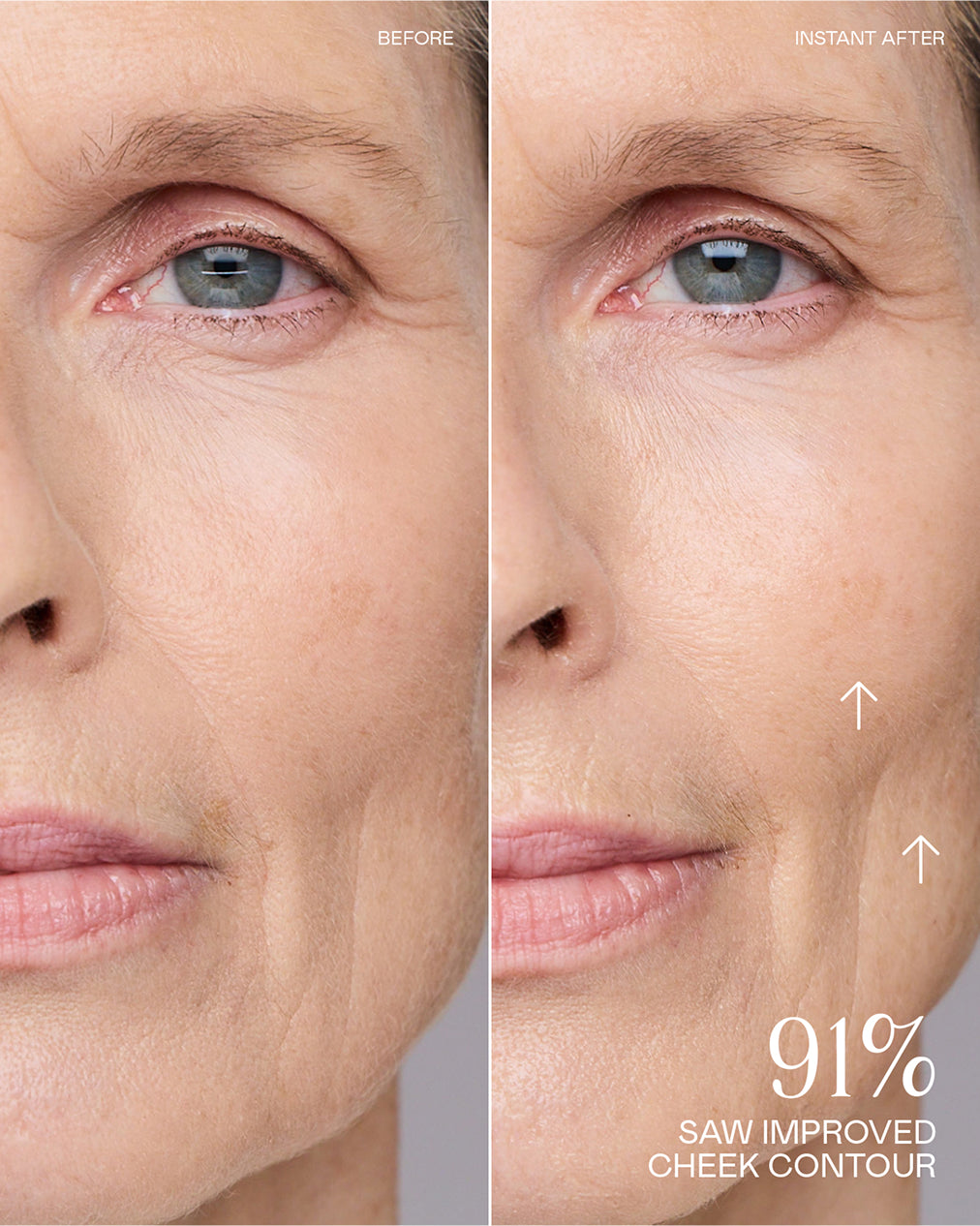 Before and After Results