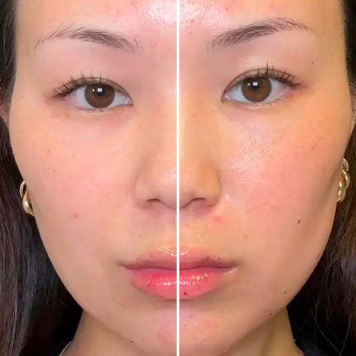 Skincare Routine before And After: Transform Your Skin Today!